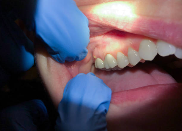 Best Emergency Gum Pain Relief  in Kirkland, IL