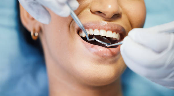 Best Knocked-Out Tooth Emergency  in Kirkland, IL